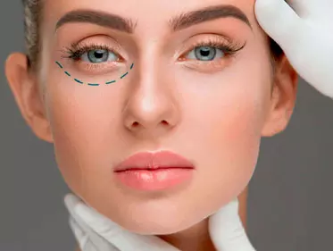 Blefaroplastia